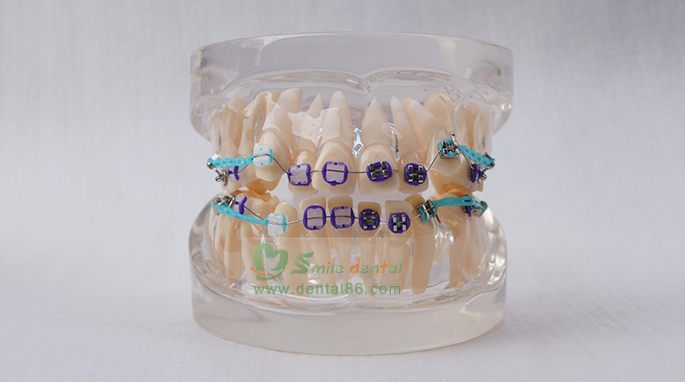 TM-B2-02 Orthodontic Model